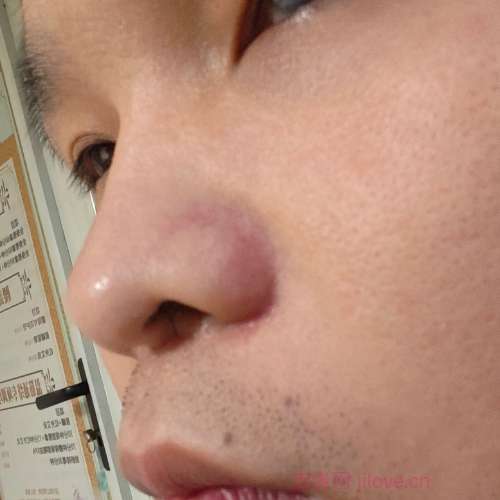 30岁岁江苏单身帅哥 - 潮州吉缘网